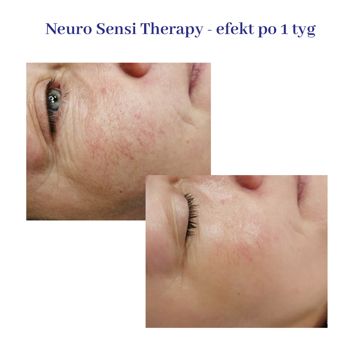 Arkana neuro sensi therapy efekty