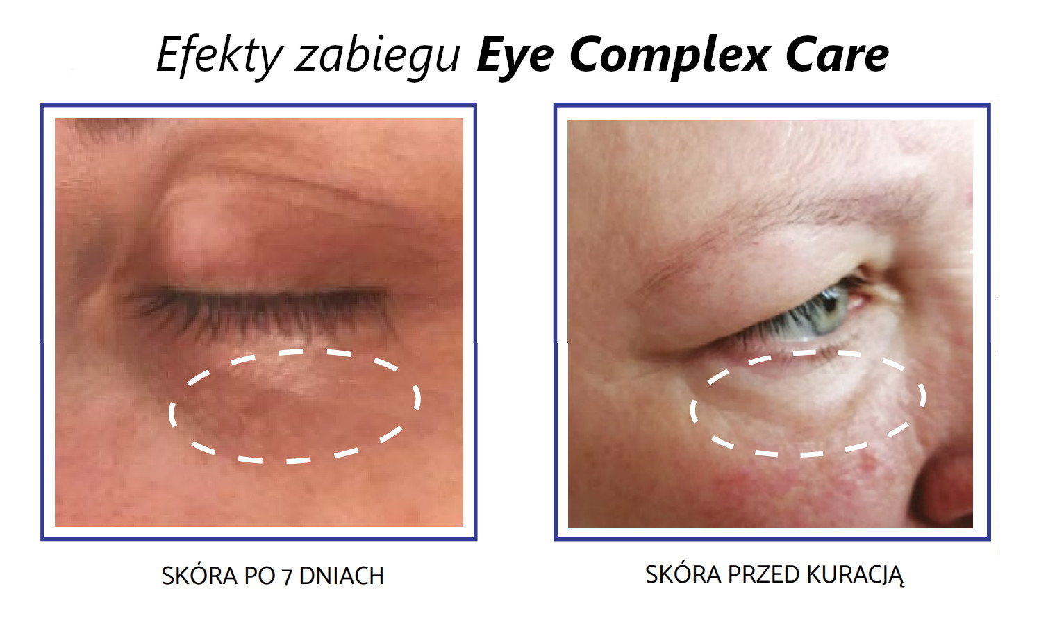 eye care complex efekty